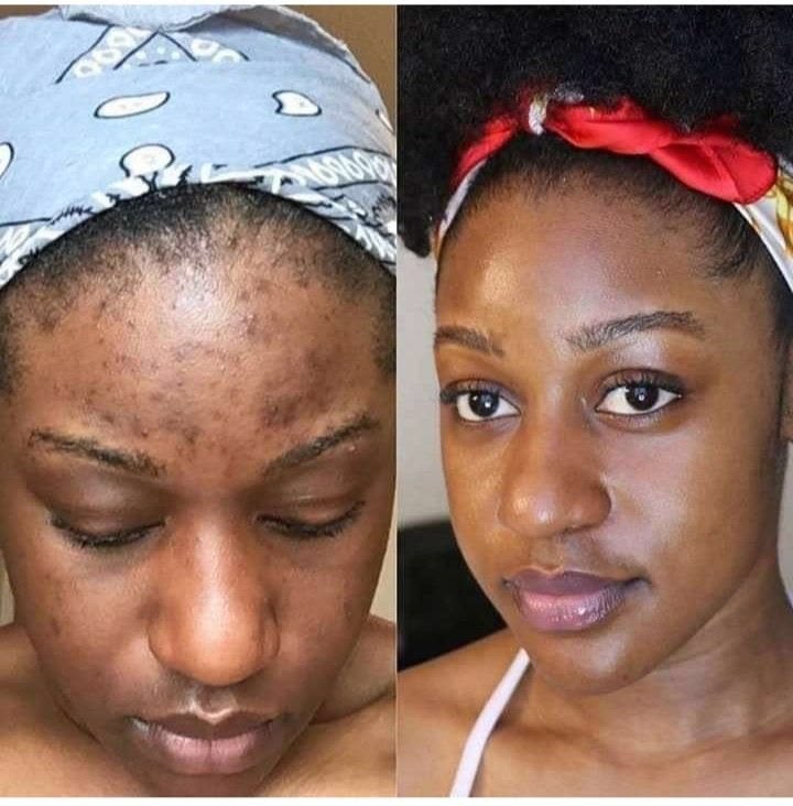 How_To_Get_Rid_Of_Dark_Spots_On_Your_Arms